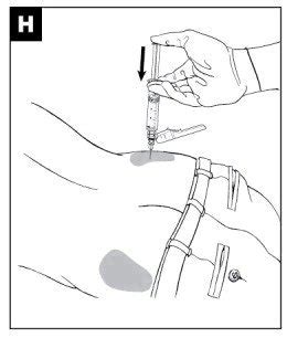 vivitrol injection area.